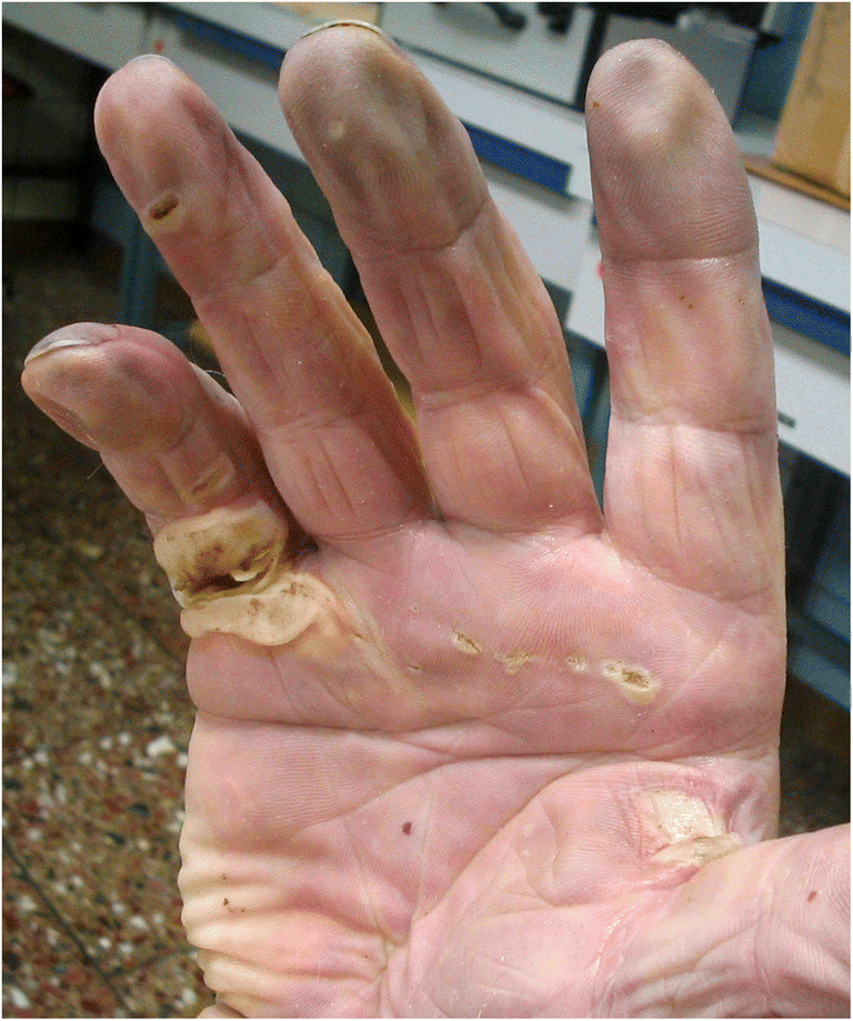 post-mortem-electricity-marks-holding-a-stripped-cable Post Mortem Electricity Marks